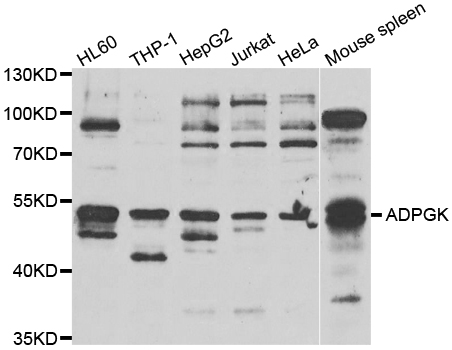 ADPGK Antibody - Western blot analysis of extracts of various cell lines.
