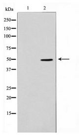 ADPGK Antibody - Western blot of Jurkat cell lysate using ADPGK Antibody