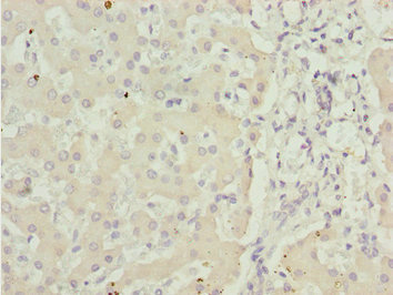 ADPGK Antibody - Immunohistochemistry of paraffin-embedded human liver tissue at dilution 1:100