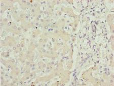 ADPGK Antibody - Immunohistochemistry of paraffin-embedded human liver tissue at dilution 1:100