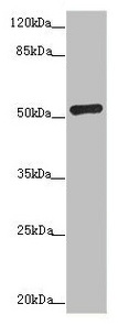 ADPGK Antibody - Western blot All lanes: ADPGK antibody at 1.02µg/ml + Hela whole cell lysate Secondary Goat polyclonal to rabbit IgG at 1/10000 dilution Predicted band size: 55, 54, 29, 25, 39, 9 kDa Observed band size: 55 kDa