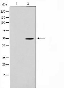 ADPGK Antibody - Western blot analysis on Jurkat cell lysates using ADPGK antibody. The lane on the left is treated with the antigen-specific peptide.