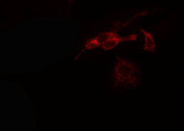 ADPGK Antibody - Staining HeLa cells by IF/ICC. The samples were fixed with PFA and permeabilized in 0.1% Triton X-100, then blocked in 10% serum for 45 min at 25°C. The primary antibody was diluted at 1:200 and incubated with the sample for 1 hour at 37°C. An Alexa Fluor 594 conjugated goat anti-rabbit IgG (H+L) antibody, diluted at 1/600, was used as secondary antibody.