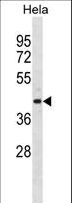 ADPRH / ARH1 Antibody - ADPRH Antibody western blot of HeLa cell line lysates (35 ug/lane). The ADPRH antibody detected the ADPRH protein (arrow).
