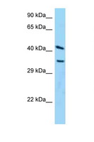 ADPRH / ARH1 Antibody - ADPRH antibody Western blot of HeLa Cell lysate. Antibody concentration 1 ug/ml.  This image was taken for the unconjugated form of this product. Other forms have not been tested.