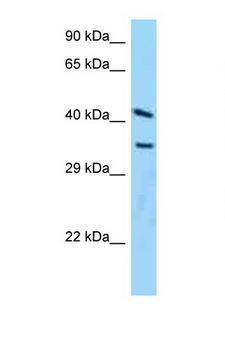 ADPRH / ARH1 Antibody - ADPRH antibody Western blot of HeLa Cell lysate. Antibody concentration 1 ug/ml.  This image was taken for the unconjugated form of this product. Other forms have not been tested.