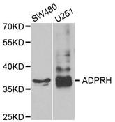 ADPRH / ARH1 Antibody - Western blot analysis of extracts of various cell lines.