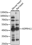 ADPRHL1 Antibody - Western blot analysis of extracts of various cell lines, using ADPRHL1 antibody at 1:1000 dilution. The secondary antibody used was an HRP Goat Anti-Rabbit IgG (H+L) at 1:10000 dilution. Lysates were loaded 25ug per lane and 3% nonfat dry milk in TBST was used for blocking. An ECL Kit was used for detection and the exposure time was 3s.