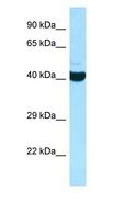 ADPRHL2 Antibody - ADPRHL2 antibody Western Blot of HepG2.  This image was taken for the unconjugated form of this product. Other forms have not been tested.