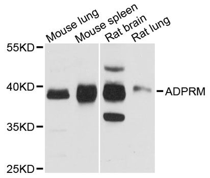 ADPRM Antibody - Western blot analysis of extracts of various cell lines, using ADPRM antibody at 1:3000 dilution. The secondary antibody used was an HRP Goat Anti-Rabbit IgG (H+L) at 1:10000 dilution. Lysates were loaded 25ug per lane and 3% nonfat dry milk in TBST was used for blocking. An ECL Kit was used for detection and the exposure time was 10s.