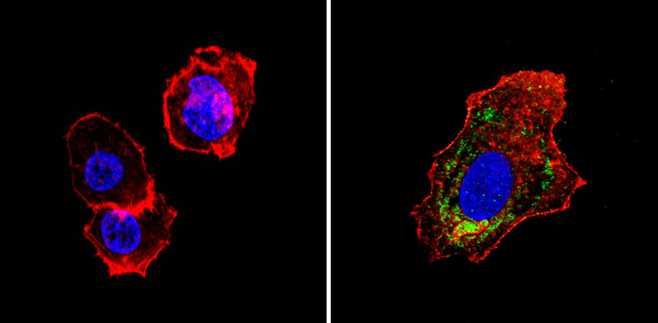 ADRA1A Antibody - IF using alpha-1 Adrenergic Receptor Antibody