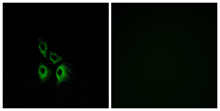 ADRA1A Antibody - Immunofluorescence analysis of A549 cells, using ADRA1A Antibody. The picture on the right is blocked with the synthesized peptide.
