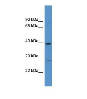 ADRA1A Antibody - Western blot of Human U937. ADRA1A antibody dilution 1.0 ug/ml.  This image was taken for the unconjugated form of this product. Other forms have not been tested.