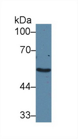 ADRA1A Antibody - Western Blot; Sample: Human Liver lysate; Primary Ab: 2µg/ml Rabbit Anti-Human ADRa1A Antibody Second Ab: 0.2µg/mL HRP-Linked Caprine Anti-Rabbit IgG Polyclonal Antibody