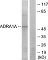 ADRA1A Antibody - Western blot analysis of lysates from lOVO cells, using ADRA1A Antibody. The lane on the right is blocked with the synthesized peptide.