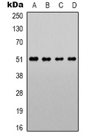 ADRA1A Antibody - Western blot analysis of Alpha-1A Adrenergic Receptor expression in LOVO (A); Jurkat (B); NIH3T3 (C); PC12 (D) whole cell lysates.