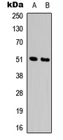 ADRA1A Antibody - Western blot analysis of Alpha-1A Adrenergic Receptor expression in HepG2 (A); K562 (B) whole cell lysates.
