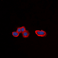 ADRA1A Antibody - Immunofluorescent analysis of Alpha-1A Adrenergic Receptor staining in HepG2 cells. Formalin-fixed cells were permeabilized with 0.1% Triton X-100 in TBS for 5-10 minutes and blocked with 3% BSA-PBS for 30 minutes at room temperature. Cells were probed with the primary antibody in 3% BSA-PBS and incubated overnight at 4 deg C in a humidified chamber. Cells were washed with PBST and incubated with a DyLight 594-conjugated secondary antibody (red) in PBS at room temperature in the dark. DAPI was used to stain the cell nuclei (blue).