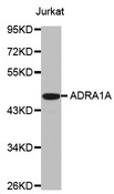 ADRA1A Antibody - Western blot analysis of extracts of Jurkat cell line, using ADRA1A antibody.