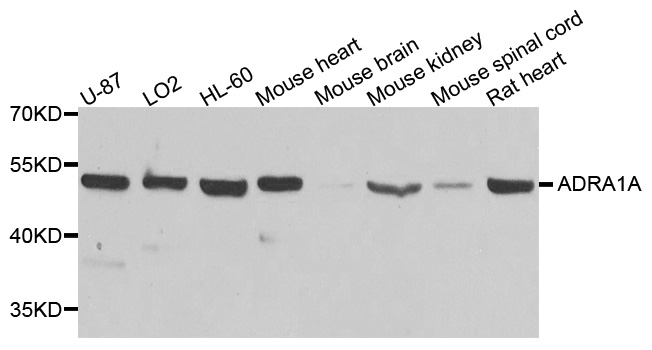 ADRA1A Antibody - Western blot analysis of extracts of various cell lines, using ADRA1A antibody at 1:1000 dilution. The secondary antibody used was an HRP Goat Anti-Rabbit IgG (H+L) at 1:10000 dilution. Lysates were loaded 25ug per lane and 3% nonfat dry milk in TBST was used for blocking. An ECL Kit was used for detection and the exposure time was 90s.