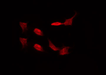 ADRA1A Antibody - Staining LOVO cells by IF/ICC. The samples were fixed with PFA and permeabilized in 0.1% Triton X-100, then blocked in 10% serum for 45 min at 25°C. The primary antibody was diluted at 1:200 and incubated with the sample for 1 hour at 37°C. An Alexa Fluor 594 conjugated goat anti-rabbit IgG (H+L) Ab, diluted at 1/600, was used as the secondary antibody.