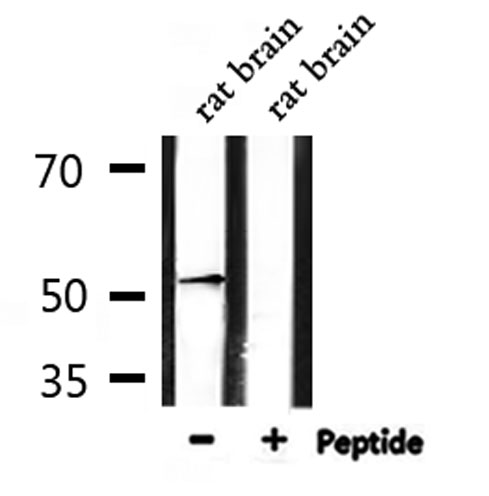 ADRA1A Antibody - Western blot analysis of extracts of mouse brain tissue using ADRA1A antibody. Lane 1 was treated with the antigen-specific peptide.