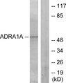ADRA1A Antibody - Western blot analysis of extracts from lOVO cells, using ADRA1A antibody.