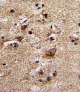 ADRA1B / Adrenoceptor alpha 1B Antibody - Formalin-fixed and paraffin-embedded human brain with ADRA1B Antibody , which was peroxidase-conjugated to the secondary antibody, followed by DAB staining. This data demonstrates the use of this antibody for immunohistochemistry; clinical relevance has not been evaluated.