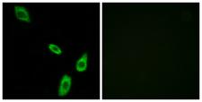 ADRA1B / Adrenoceptor alpha 1B Antibody - Immunofluorescence analysis of LOVO cells, using ADRA1B Antibody. The picture on the right is blocked with the synthesized peptide.