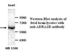 ADRA1B / Adrenoceptor alpha 1B Antibody