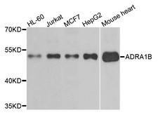 ADRA1B / Adrenoceptor alpha 1B Antibody - Western blot analysis of extracts of various cells.