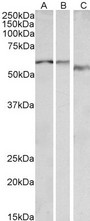 ADRA1B Antibody - Goat Anti-ADRA1B Antibody (0.1µg/ml) staining of Human Heart lysate (35µg protein in RIPA buffer). Primary incubation was 1 hour. Detected by chemiluminescencence.