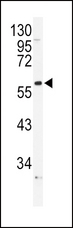ADRA1B Antibody - Western blot of ADRA1B Antibody in NCI-H460 cell line lysates (35 ug/lane). ADRA1B (arrow) was detected using the purified antibody.