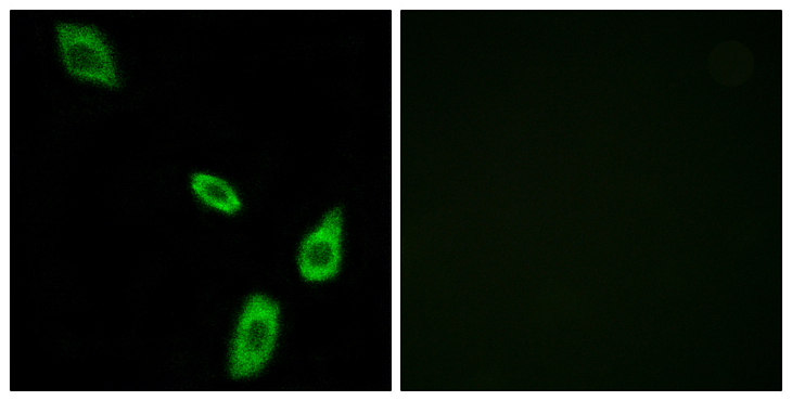 ADRA1B Antibody - Immunofluorescence analysis of LOVO cells, using ADRA1B Antibody. The picture on the right is blocked with the synthesized peptide.