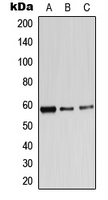 ADRA1B Antibody - Western blot analysis of Alpha-1B Adrenergic Receptor expression in A549 (A); HEK293T (B); PC12 (C) whole cell lysates.