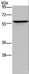 ADRA1B Antibody - Western blot analysis of Human lung cancer tissue, using ADRA1B Polyclonal Antibody at dilution of 1:550.