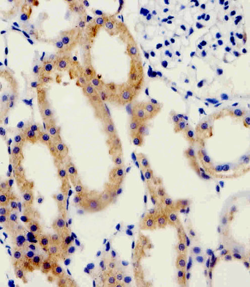 ADRA1D / Adrenoceptor alpha 1D Antibody - Immunohistochemical of paraffin-embedded R. kidney section using ADRA1D Antibody. Antibody was diluted at 1:100 dilution. A peroxidase-conjugated goat anti-rabbit IgG at 1:400 dilution was used as the secondary antibody, followed by DAB staining.