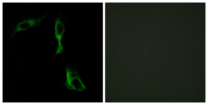 ADRA1D / Adrenoceptor alpha 1D Antibody - Immunofluorescence analysis of HeLa cells, using ADRA1D Antibody. The picture on the right is blocked with the synthesized peptide.