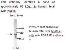 ADRA1D / Adrenoceptor alpha 1D Antibody