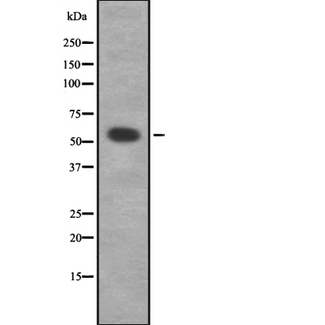 ADRA1D / Adrenoceptor alpha 1D Antibody - Western blot analysis of ADRA1D using K562 whole cells lysates