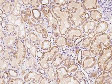 ADRA1D / Adrenoceptor alpha 1D Antibody - Immunochemical staining of human ADRA1D in human kidney with rabbit polyclonal antibody at 1:100 dilution, formalin-fixed paraffin embedded sections.