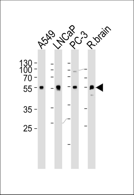 ADRA1D Antibody - Western blot of lysates from A549, LNCaP, PC-3 cell line and rat brain tissue lysate (from left to right) with ADRA1D Antibody. Antibody was diluted at 1:1000 at each lane. A goat anti-rabbit IgG H&L (HRP) at 1:5000 dilution was used as the secondary antibody. Lysates at 35 ug per lane.