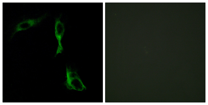 ADRA1D Antibody - Immunofluorescence analysis of HeLa cells, using ADRA1D Antibody. The picture on the right is blocked with the synthesized peptide.