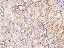 ADRA1D Antibody - Immunochemical staining of human ADRA1D in human kidney with rabbit polyclonal antibody at 1:100 dilution, formalin-fixed paraffin embedded sections.