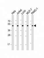 ADRA2A Antibody - All lanes: Anti-ADRA2A Antibody (N-Term) at 1:2000 dilution. Lane 1: HeLa whole cell lysate. Lane 2: Jurkat whole cell lysate. Lane 3: LoVo whole cell lysate. Lane 4: MCF-7 whole cell lysate. Lane 5: PANC-1 whole cell lysate Lysates/proteins at 20 ug per lane. Secondary Goat Anti-Rabbit IgG, (H+L), Peroxidase conjugated at 1:10000 dilution. Predicted band size: 49 kDa. Blocking/Dilution buffer: 5% NFDM/TBST.
