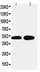 ADRA2A Antibody - WB of ADRA2A antibody. Lane 1: HELA Cell Lysate. Lane 2: PANC Cell Lysate.