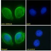 ADRA2A Antibody - ADRA2A antibody immunofluorescence analysis of paraformaldehyde fixed MCF7 cells, permeabilized with 0.15% Triton. Primary incubation 1hr (10ug/ml) followed by Alexa Fluor 488 secondary antibody (2ug/ml), showing membrane staining. The nuclear stain is DAPI (blue). Negative control: Unimmunized goat IgG (10ug/ml) followed by Alexa Fluor 488 secondary antibody (2ug/ml).