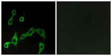 ADRA2A Antibody - Immunofluorescence analysis of LOVO cells, using ADRA2A Antibody. The picture on the right is blocked with the synthesized peptide.