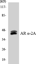 ADRA2A Antibody - Western blot analysis of the lysates from Jurkat cells using Adrenergic Receptor Î±-2A antibody.