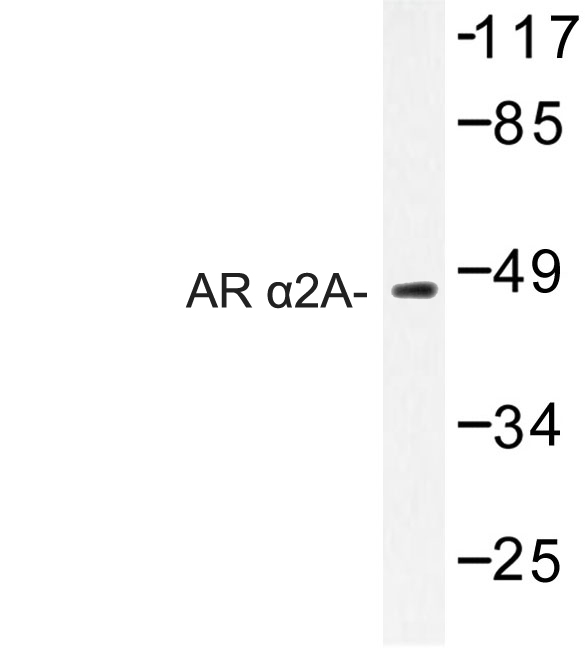 ADRA2A Antibody - Western blot of AR 2A (R361) pAb in extracts from Jurkat cells.
